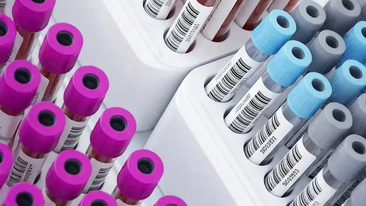 Des tubes de prélèvement sanguin alignés dans un laboratoire