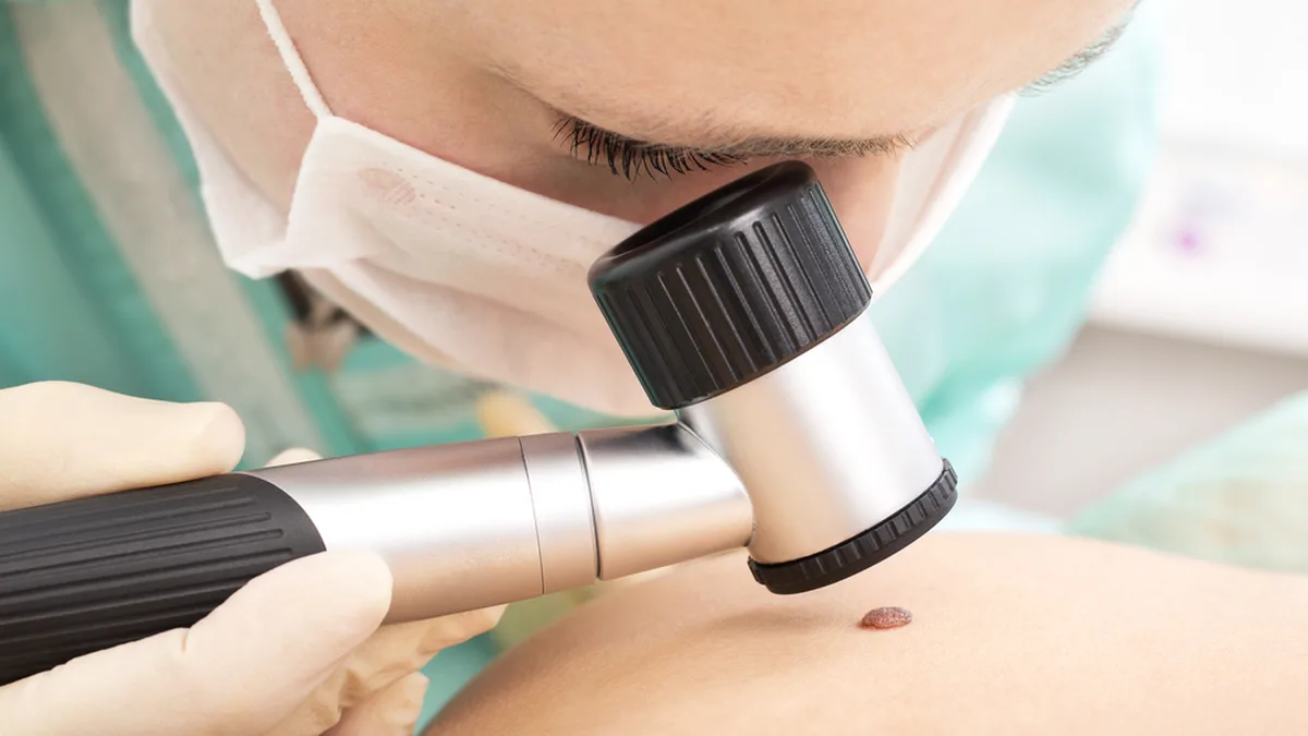 Un dermatologue examine la peau d&rsquo;un patient pour dépister un cancer